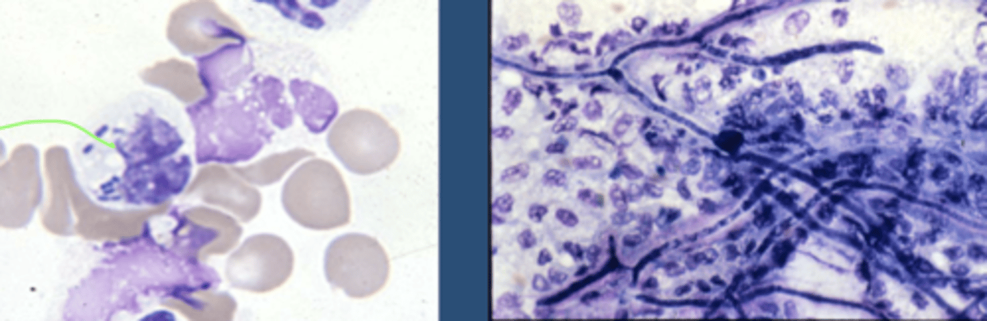 <p>hyphae enter into cells, haustoria produced in cells</p>
