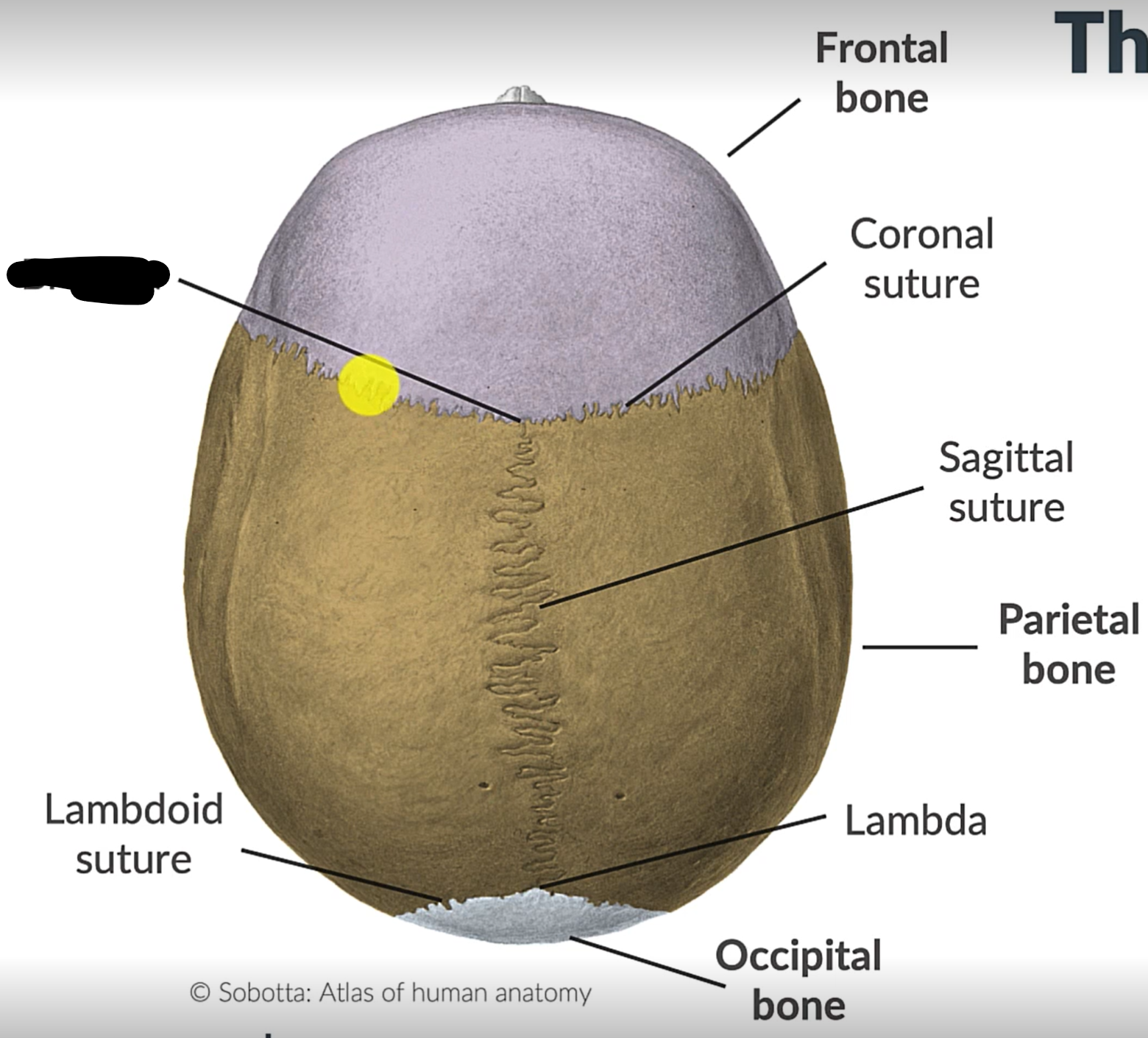 <p>What is the point where the frontal and parietal bones meet?</p>