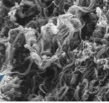 <p>Papillary layer</p>