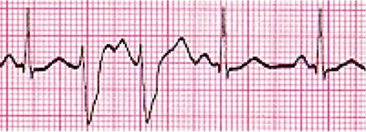 <p>what PVC does this show</p>