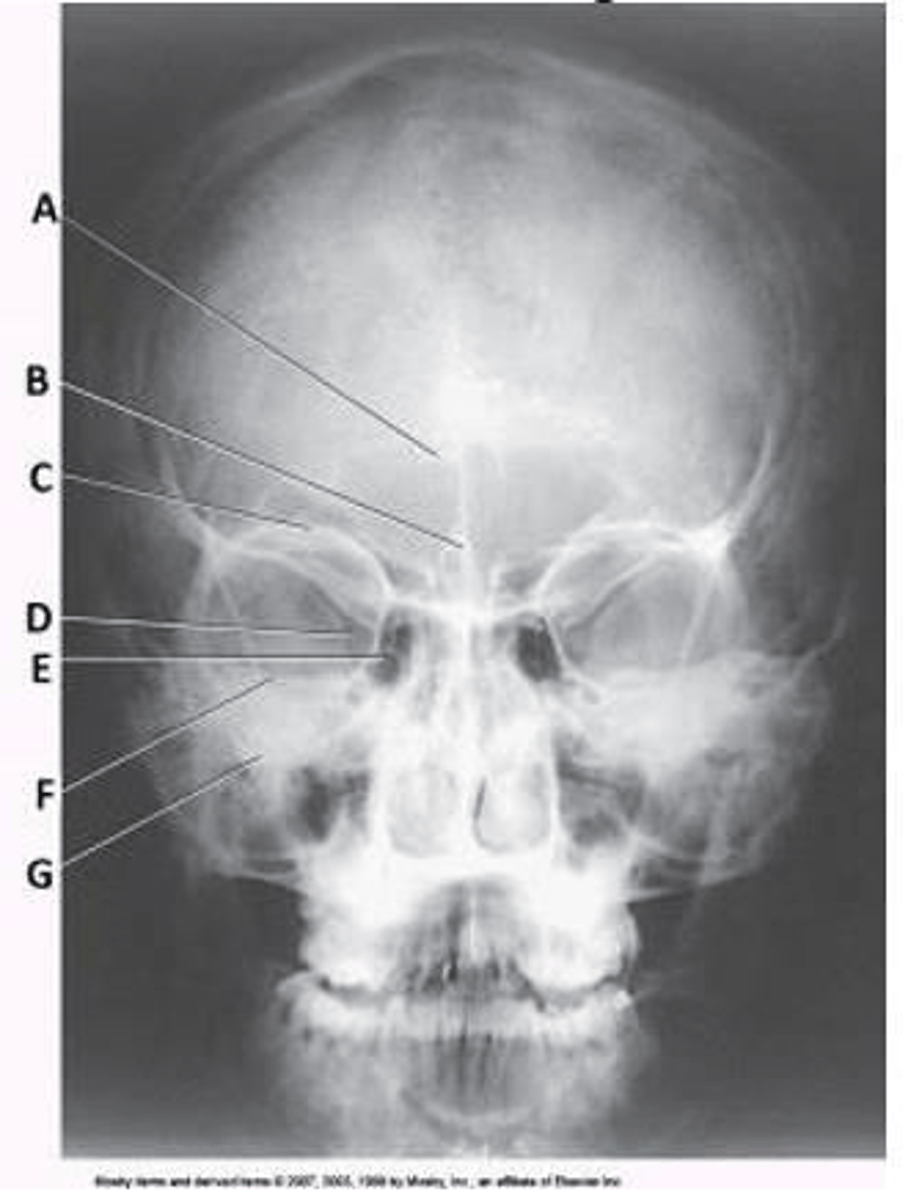 <p>c. petrous ridge.</p>