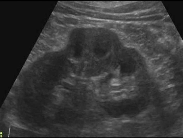 <p>What is this image showing:</p>