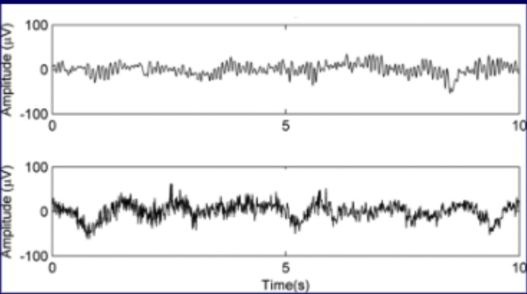<p>yes. Electrocautery can produce chatoic electric wave throughout body. ICD recognizes this and thinks pt is having heart attack and will shock the pt.</p>