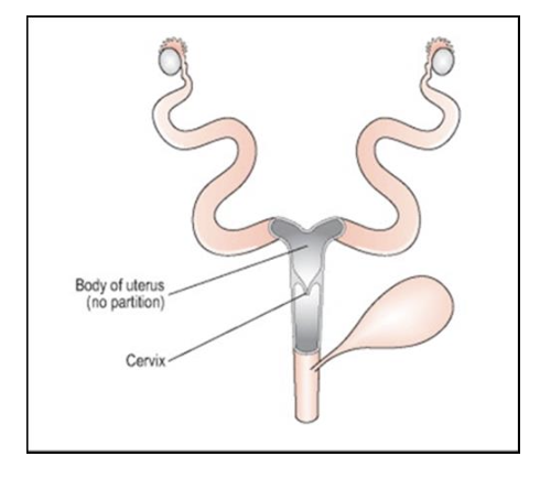 <p>What type of uterus do rodents have, and which species have this type?</p>