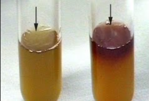 <p>What is/are detected in this set-up which serves as the <strong>energy reserve </strong>of the organisms in the culture medium?</p>