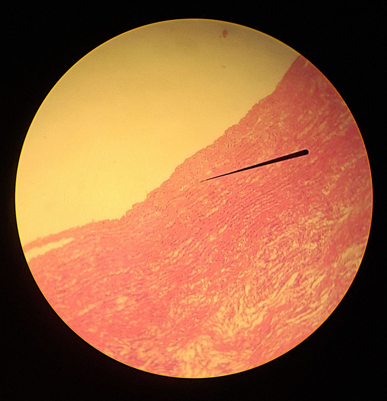 <p>Identify the tissue and mention one site</p>
