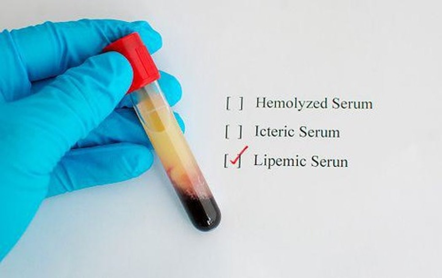 <p>It indicates a lipemic sample.</p>