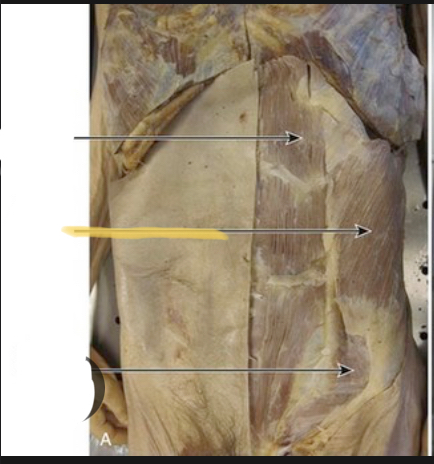 <p>Identify the highlighted muscle</p>