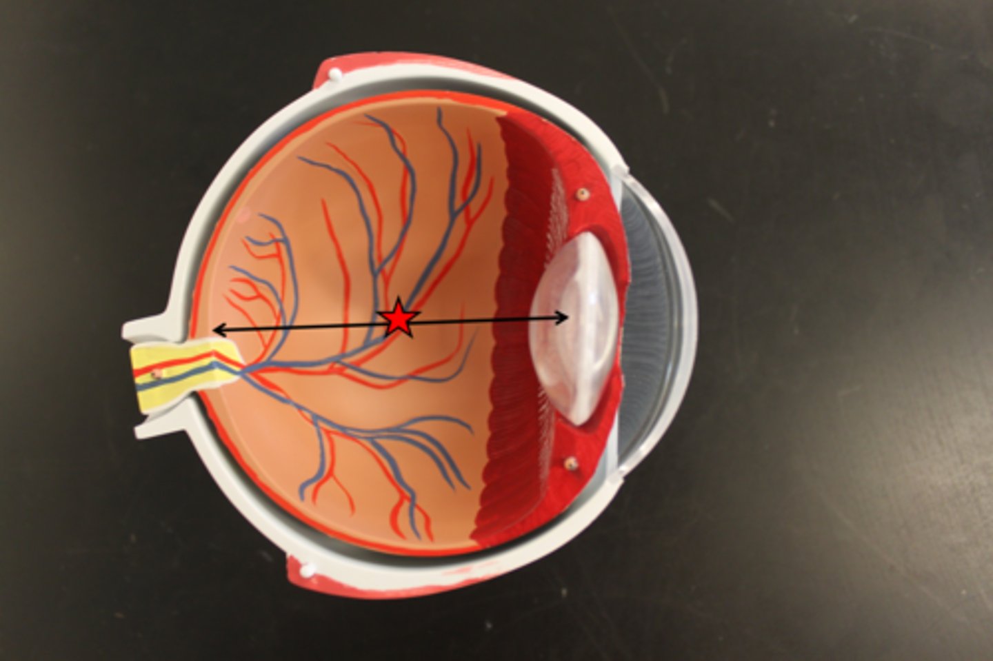 <p>between iris and lens</p>