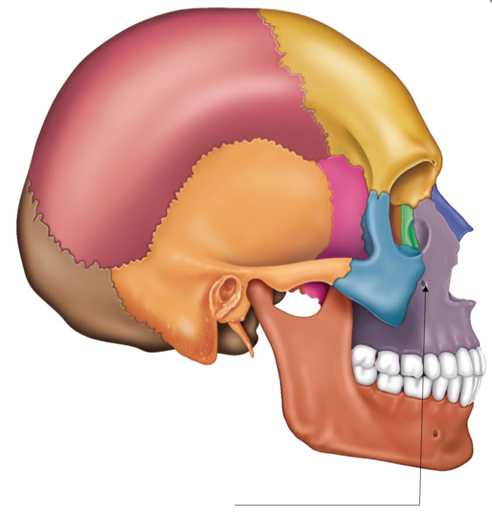 term image