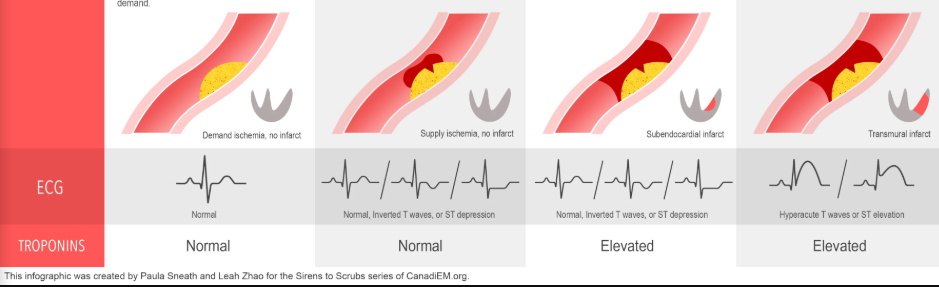 <p>Name the disease from left to right</p>