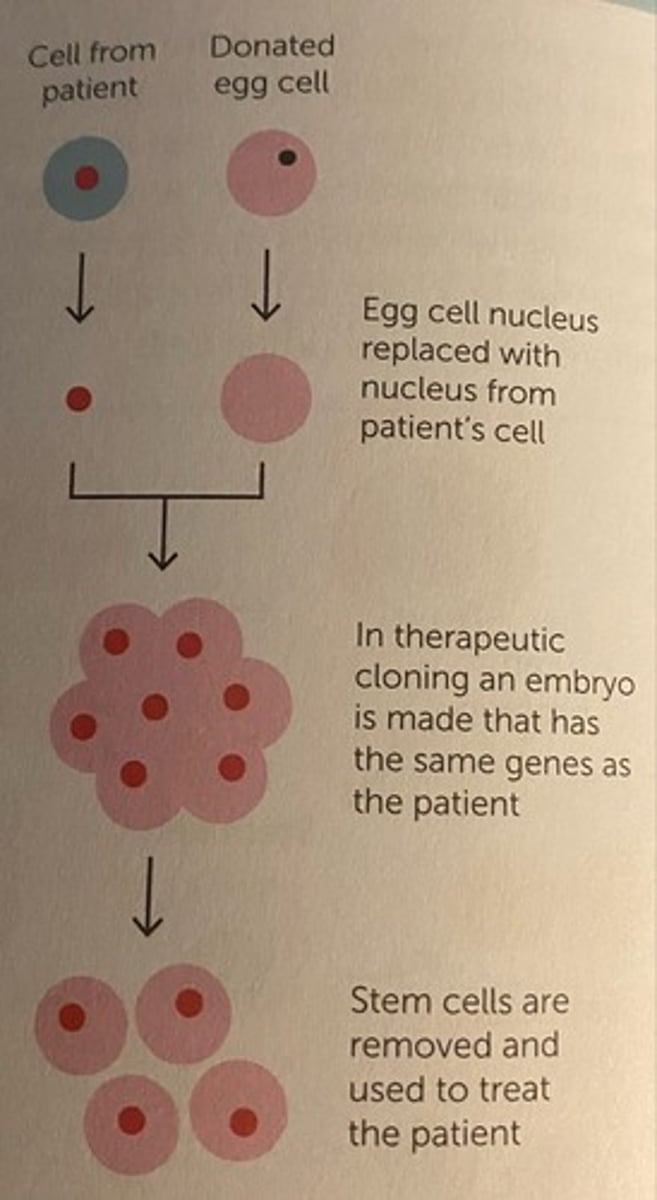 <p>When a cloned embryo of the patient is made and used as a source of stem cells</p>