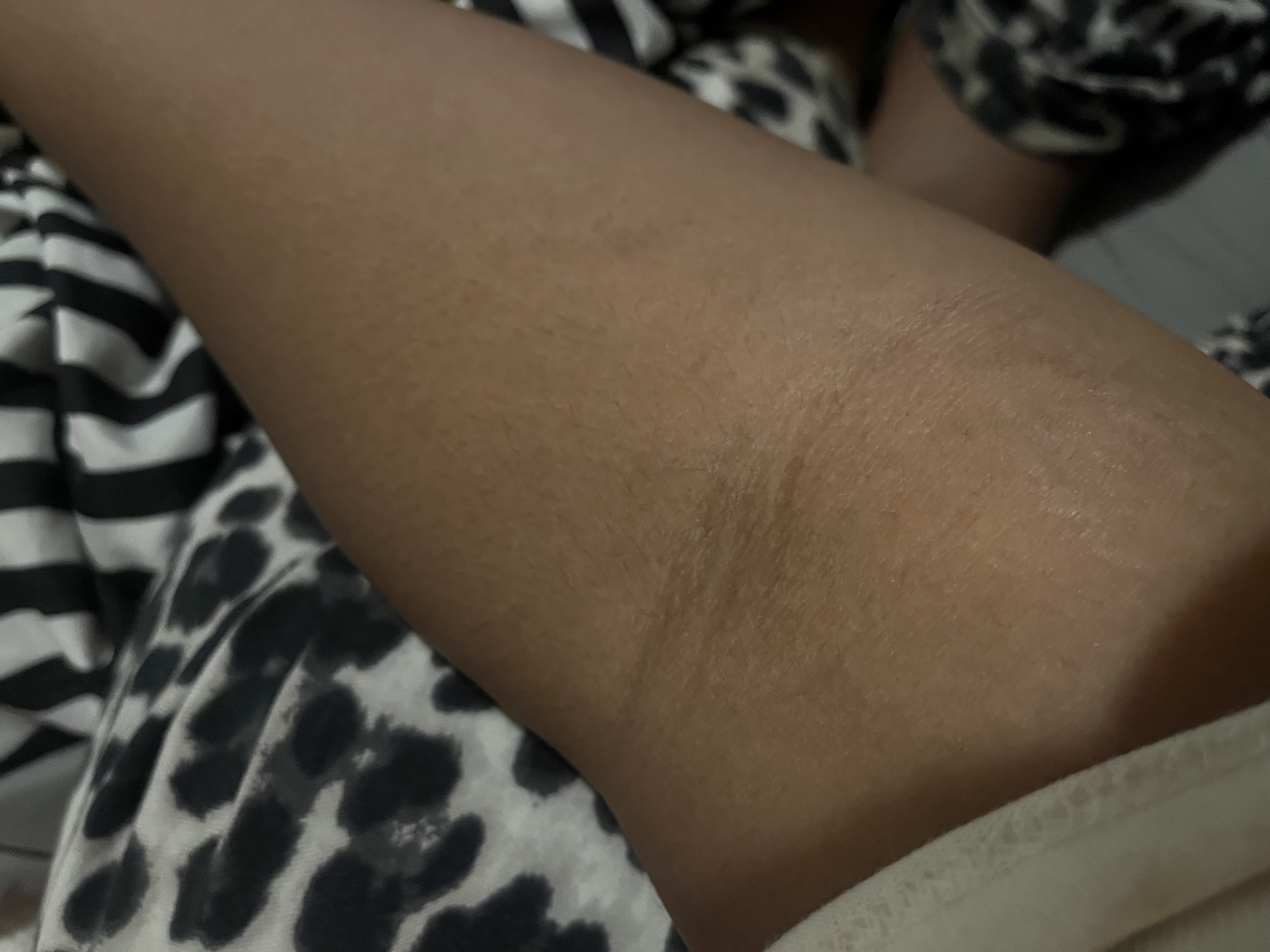 <p>Front elbow</p>