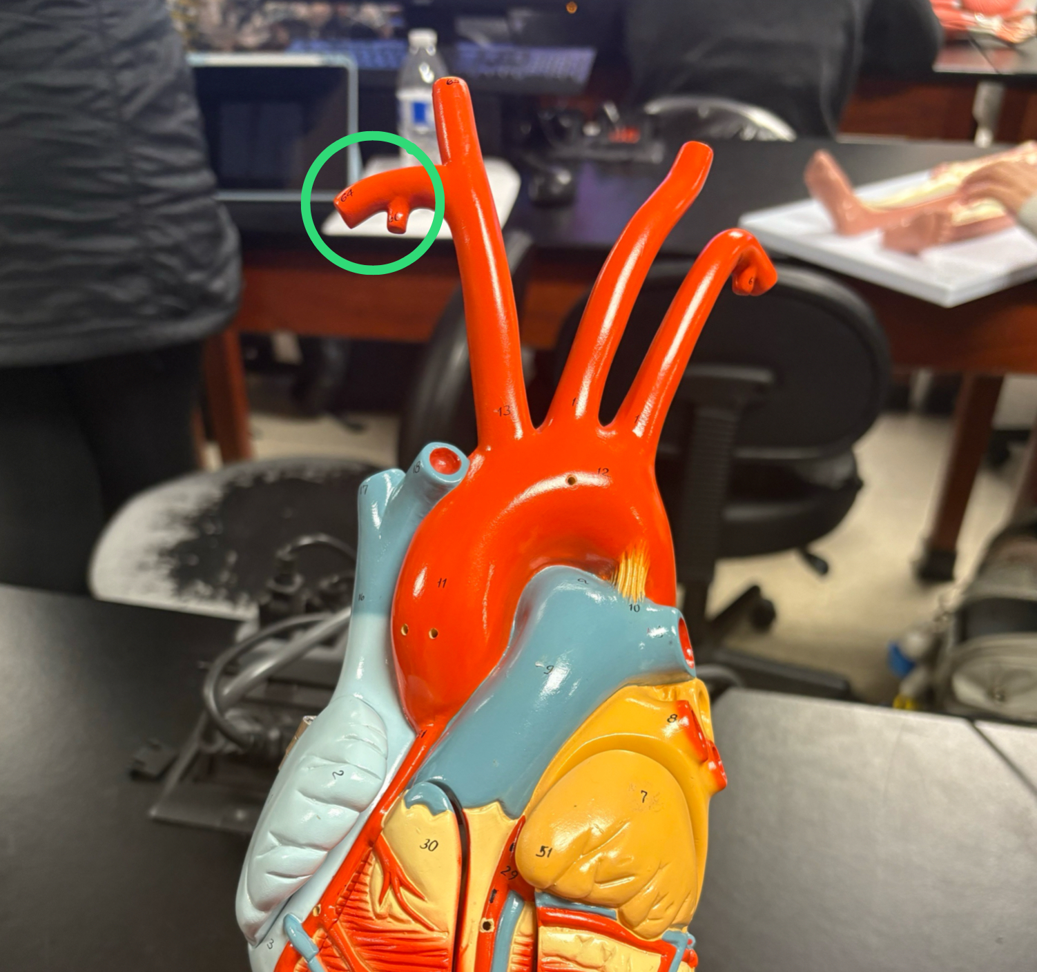 <p>artery that splits off the side of brachiocephalic artery</p>