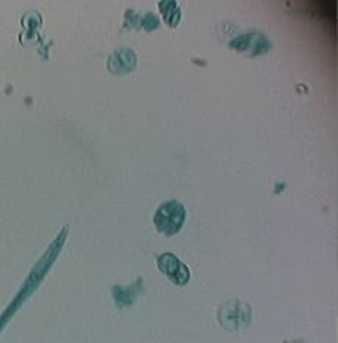 <p>Identify the Green alga shown</p>