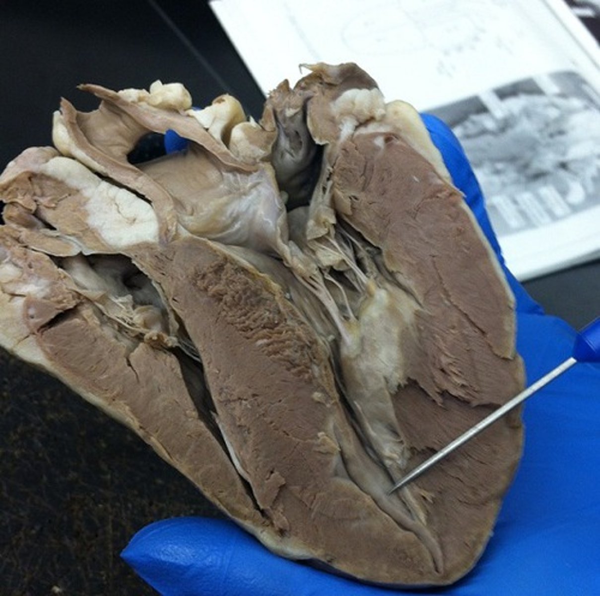 <p>the simple squamous epithelium that lines the heart (layer)</p><p>inside part</p>