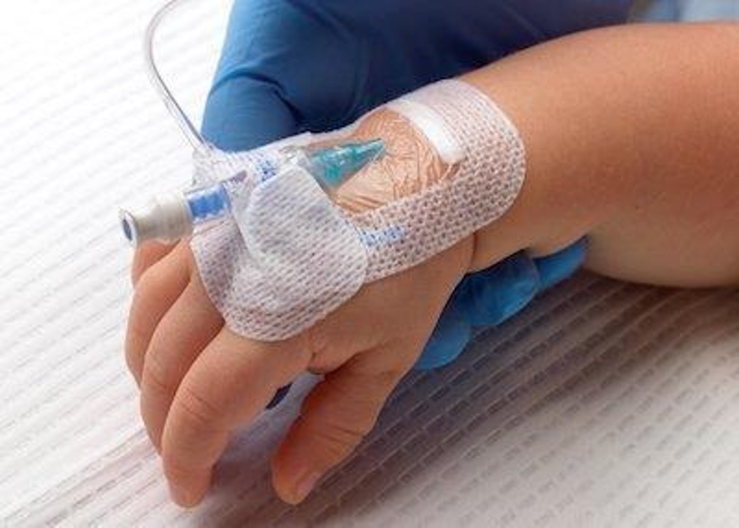 <p>Small flexible catheter inserted into a vein, commonly located in the lower portion of the arm or back of the hand, used for administering fluids and/or necessary medications.</p>