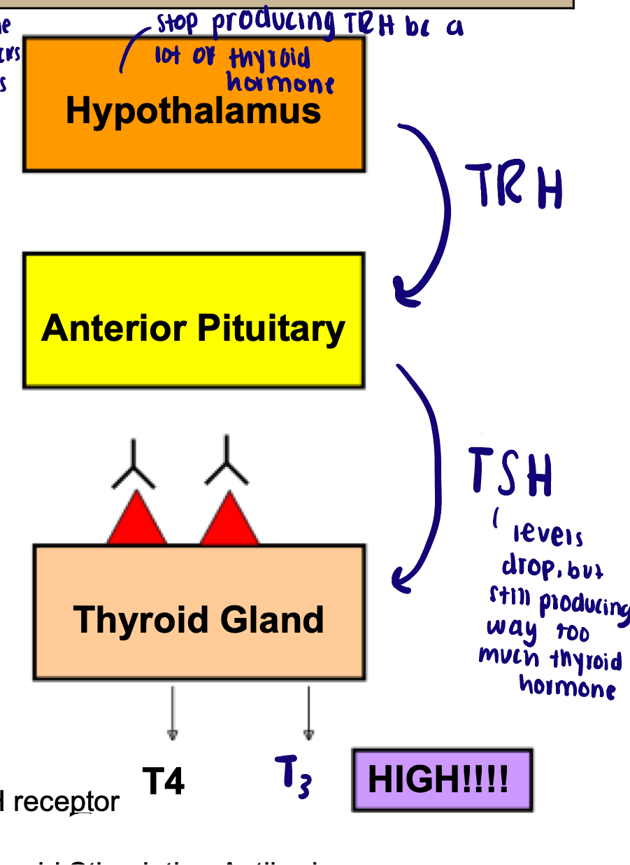 <ul><li><p>Excess thyroid hormone </p></li><li><p>Most common cause: Grave’s disease (autoimmune disorder)</p><ul><li><p>Antibody activates TSH receptor on thyroid gland → thinks TSH is present → produces a lot of thyroid hormone</p></li><li><p>Goiter and increased T4 and T3</p></li></ul></li><li><p>Symptoms:</p><ul><li><p>Increased: metabolism, food intake, weight loss, sweating, muscle weakness, nervousness, heart rate</p></li><li><p>Diarrhea and Polyuria </p></li></ul></li><li><p>Graves opthalmopathy</p><ul><li><p>Eye bulging </p></li><li><p>Anti-body binds to soft tissue around eye to fat → pushes eye forward </p></li></ul></li></ul><p></p>