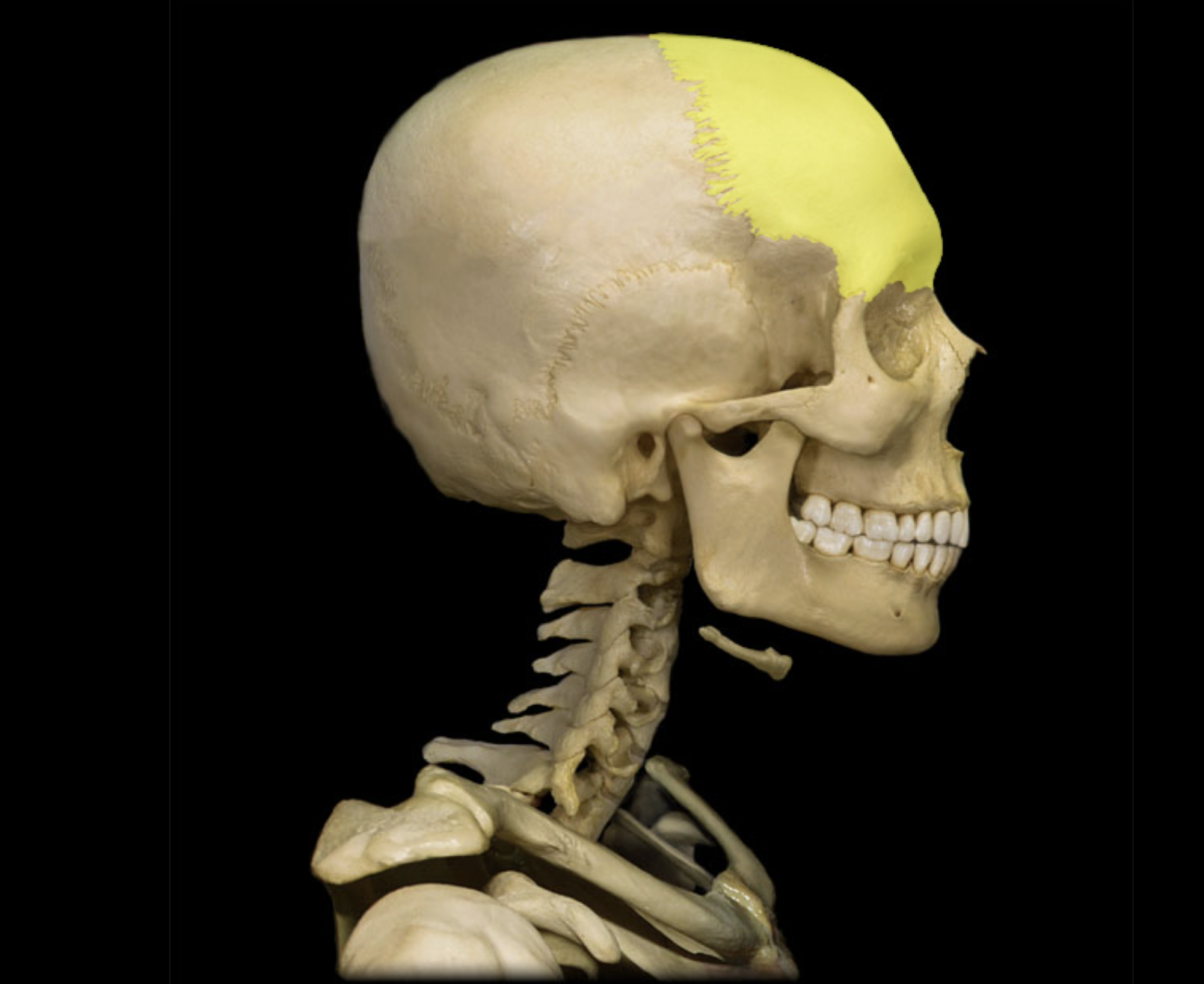 <p>Frontal bone</p>
