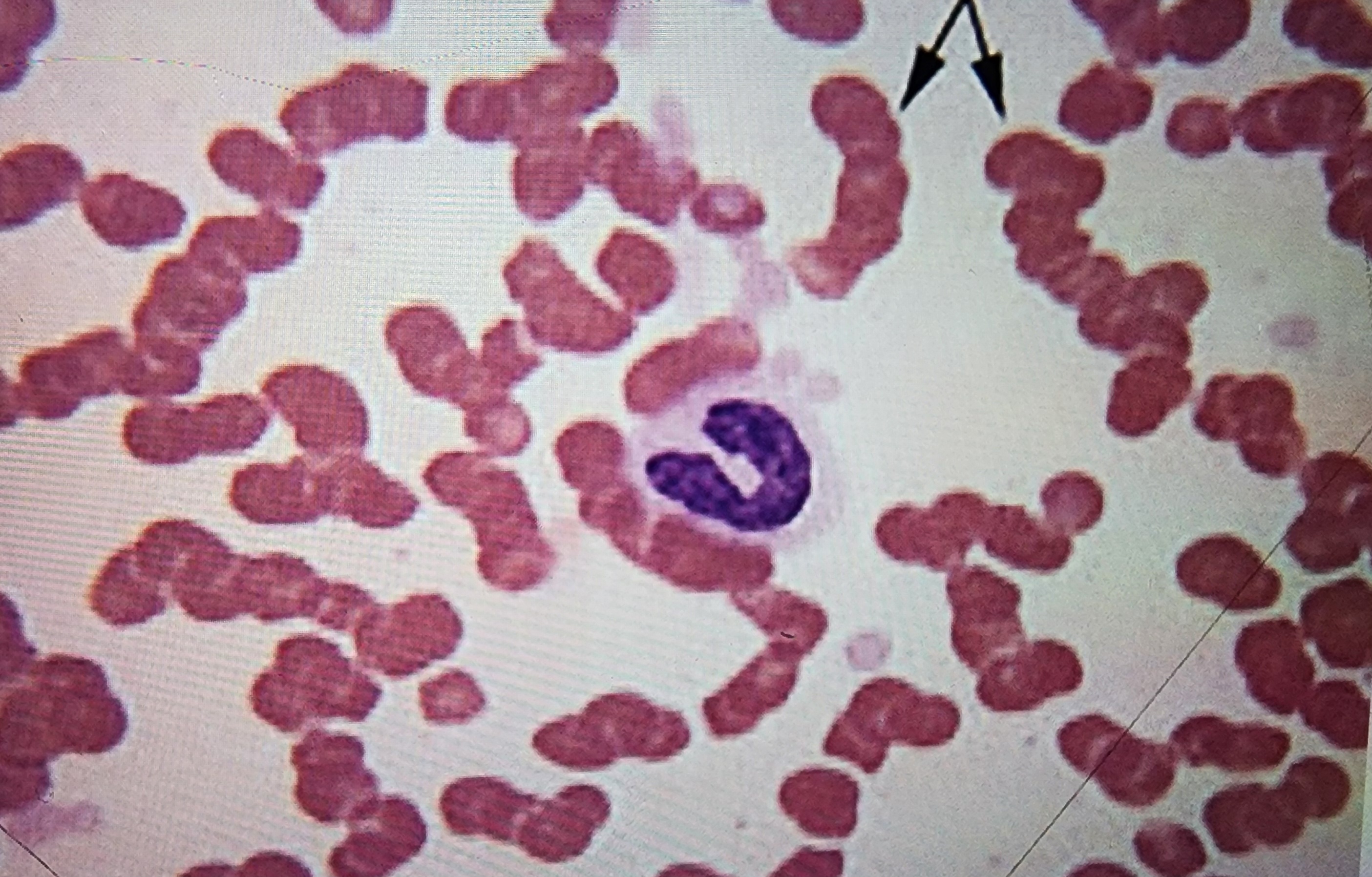 <p>coin stacking</p>