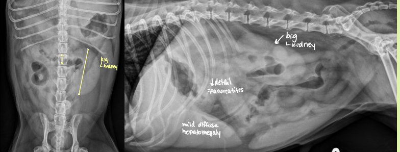 <p>condition where one kidney becomes enlarged to compensate for a down kidney</p>