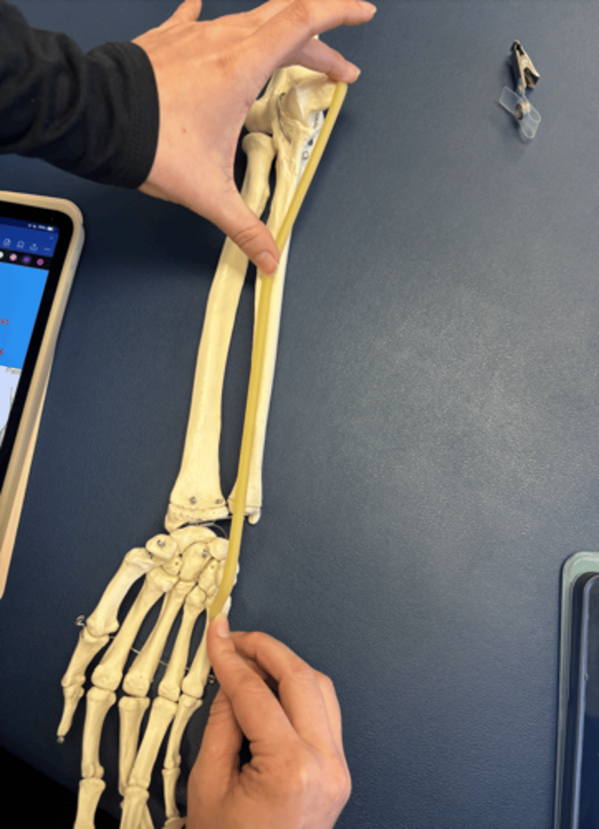 <p>What is this muscle?</p>