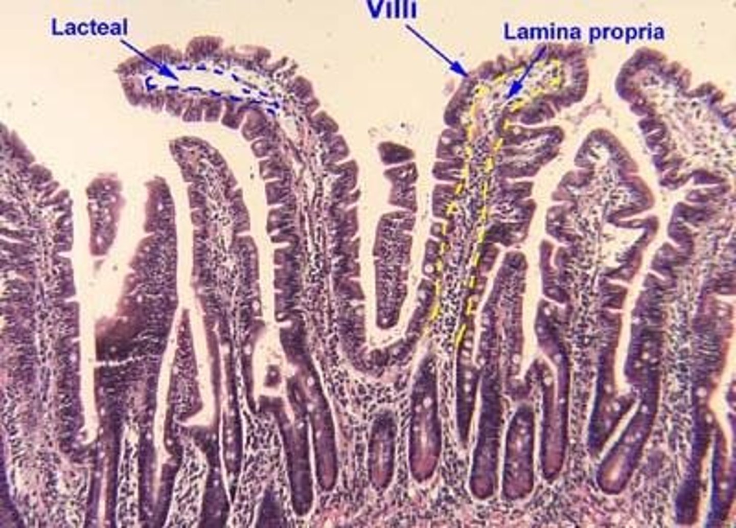 <p>Clusters of lymphoid follicles in the wall of the distal small intestine.</p>