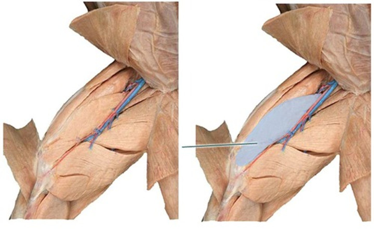 <p>what muscle is highlighted?</p>