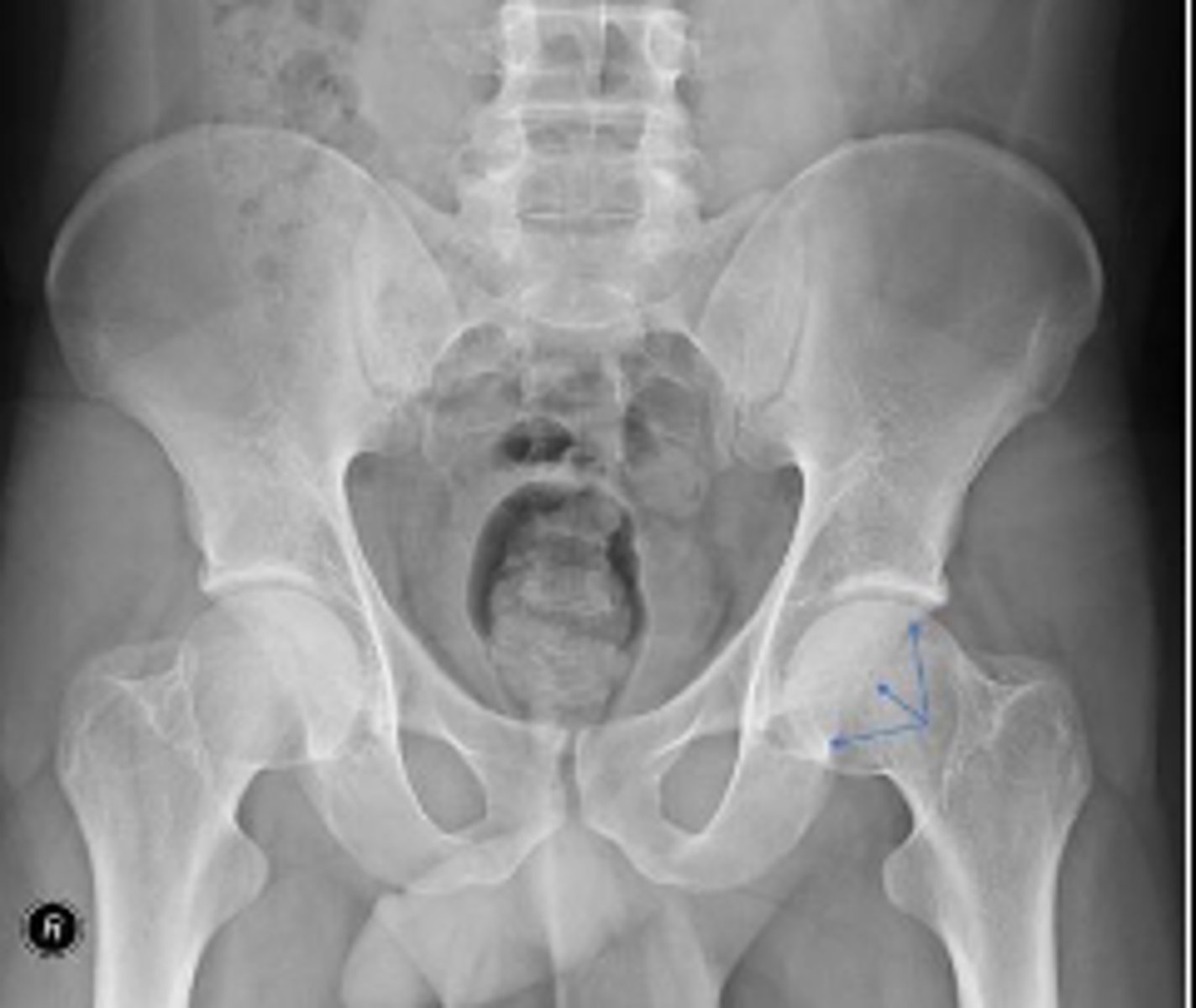 <p>What are the arrows pointing to?</p>