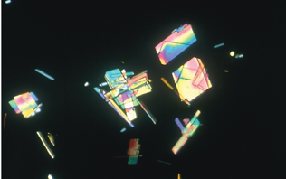 <p>Identify the urine sediment element shown and what perspective it is in</p>