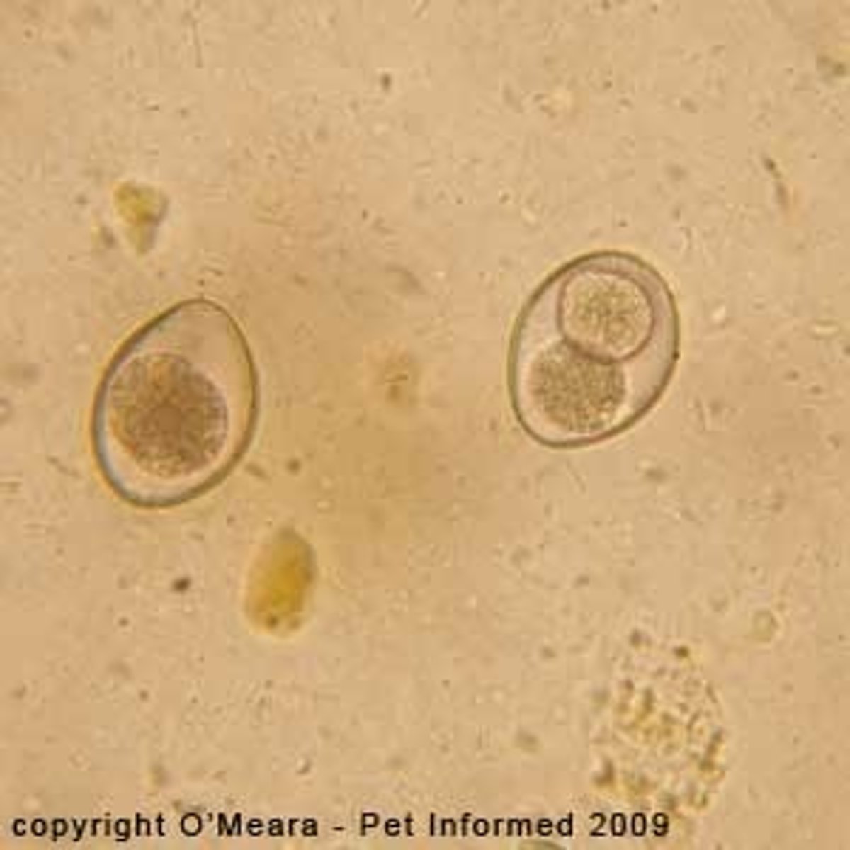 <p>Cyst</p>