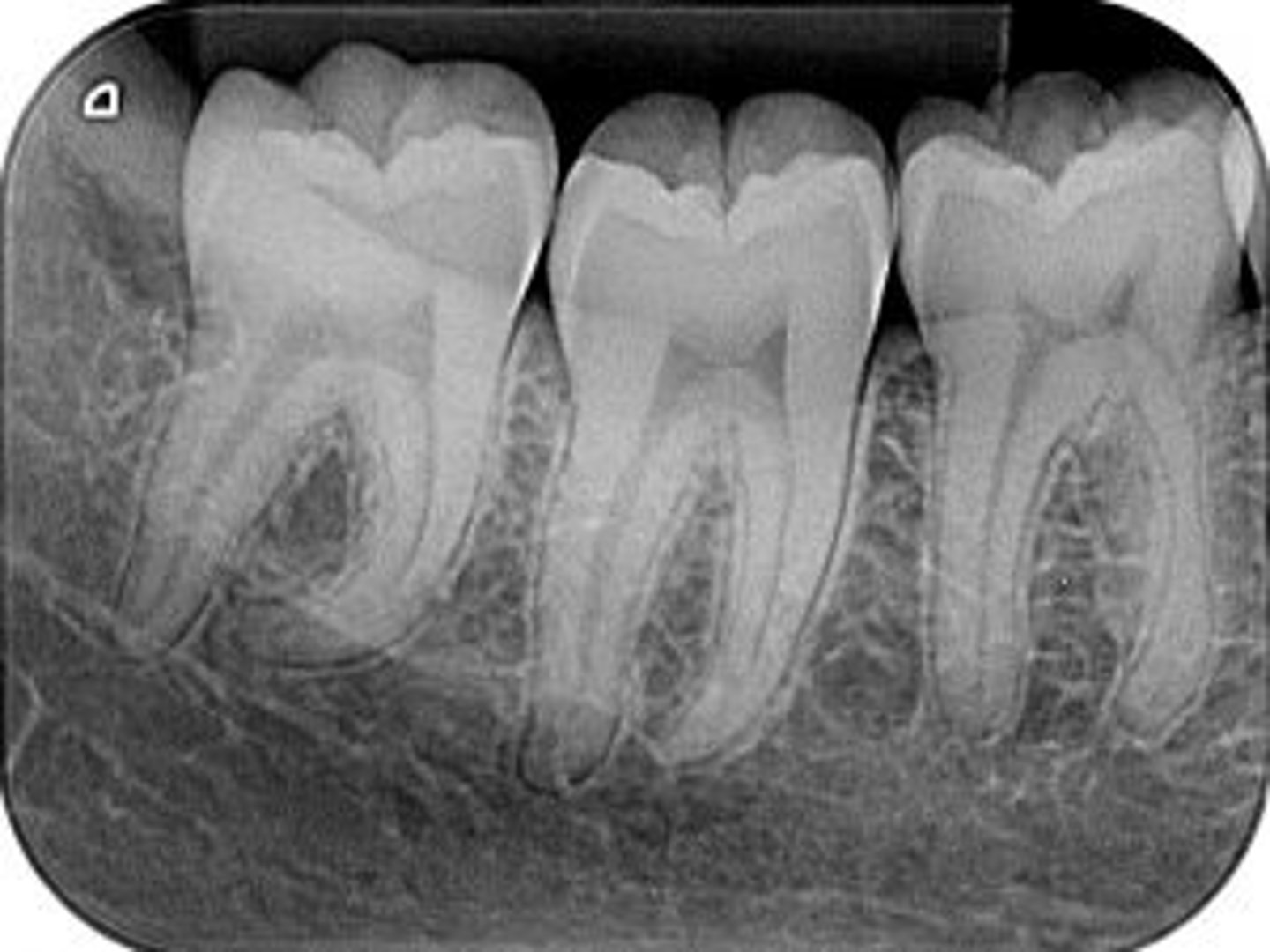 <p>radiographic image showing the crown, root tip, &amp; surrounding structures</p>