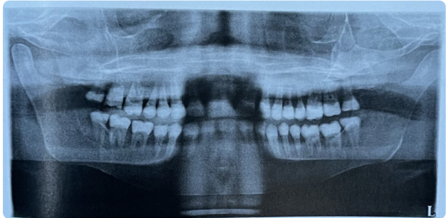 term image