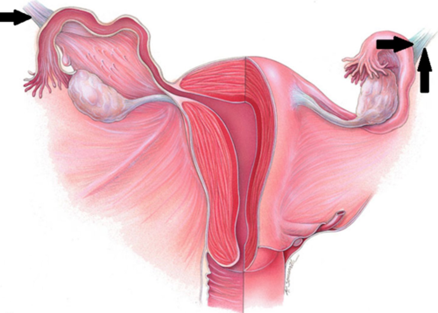 <p>Peritoneum folding over ovarian vessels, nerves, lymphatics</p>