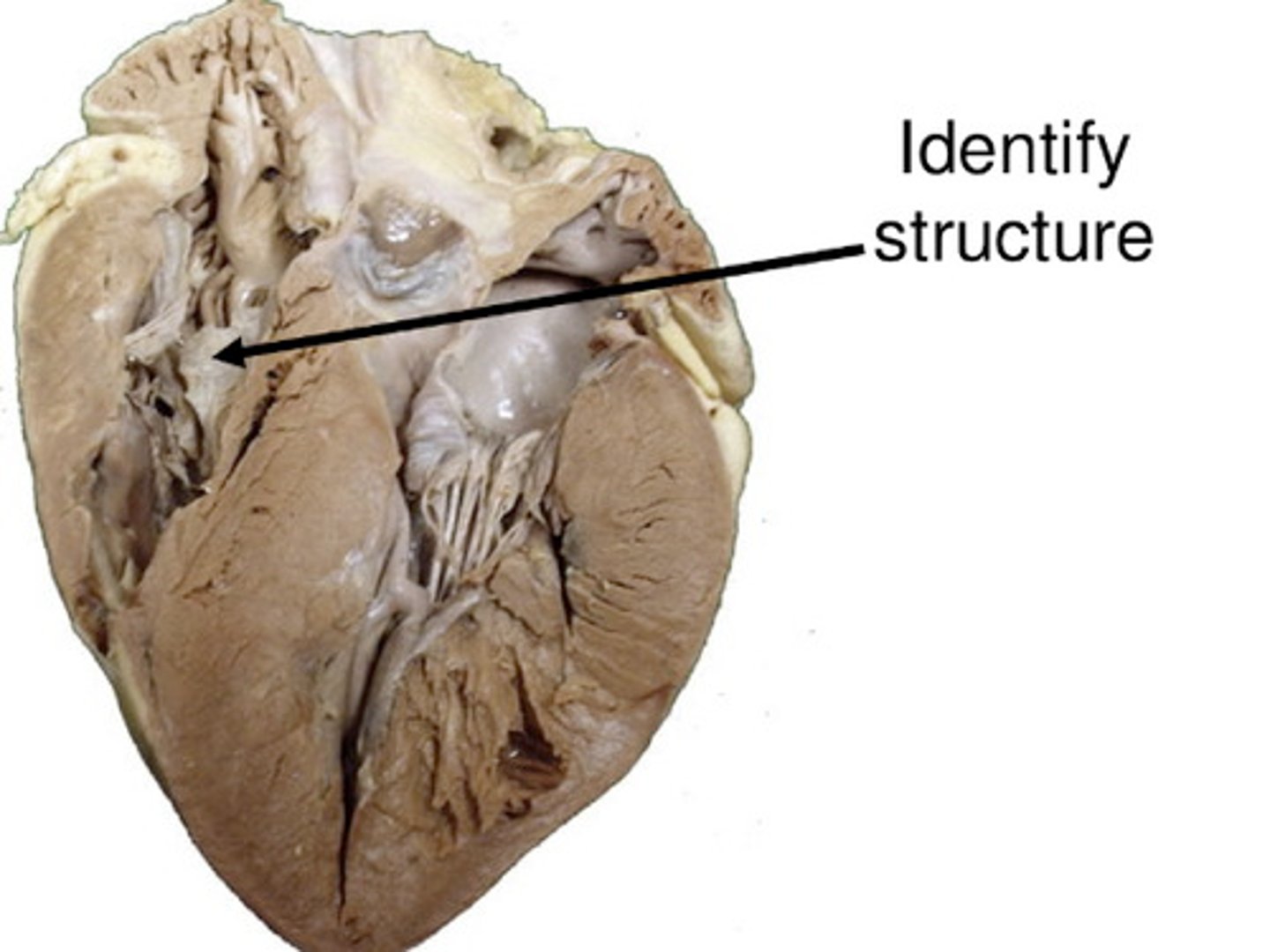 <p>What valves lays on the Right side of the heart?</p>