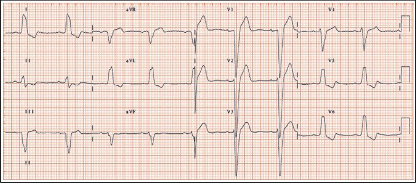 <p>what is this?</p>