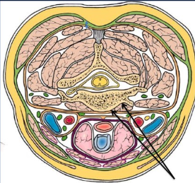 <p>-potential space between the prevertebral fascia and the anterior surface of vertebral bodies of the cervical spine</p>