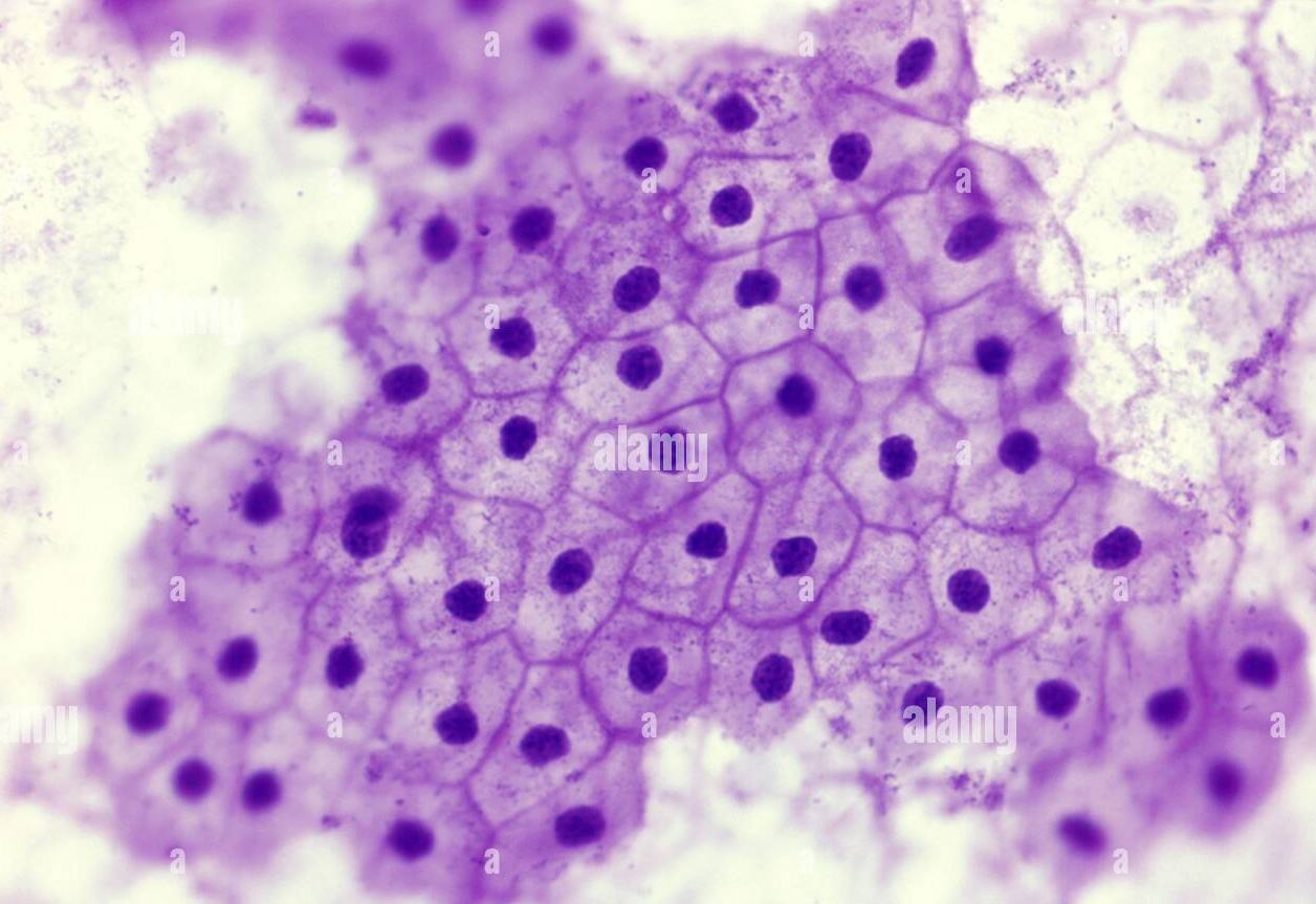 <p>simple squamous epithelium</p>