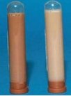 <p>Body cavity effusions</p><p>What is this? Why?</p>