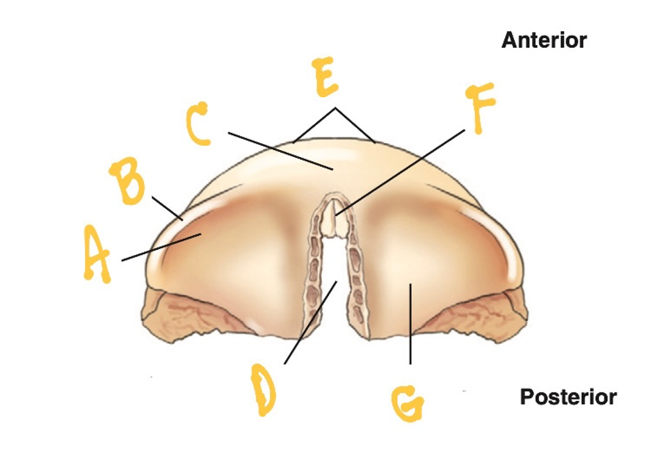 <p>E</p><ul><li><p>On each side of the squamous portion of the frontal bone <strong>above the SOG</strong></p></li><li><p>a larger, <strong>rounded prominence</strong></p></li></ul><p></p>