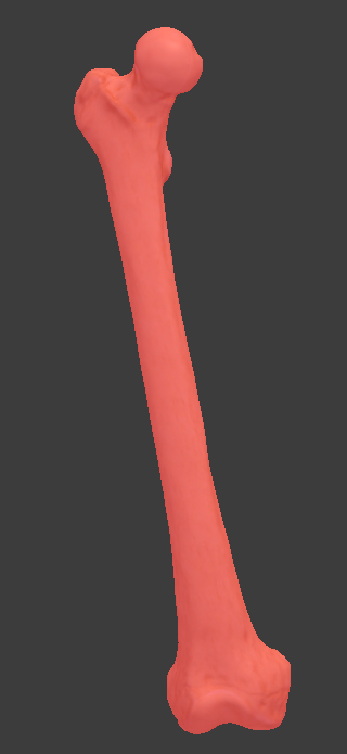 <p>What structure is highlighted in red?</p>