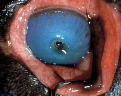 <p><span style="background-color: transparent;"><strong><span>Deep Descemetocele Ulcer</span></strong></span></p>