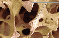 <p>What is the term used to describe what this picture depicts?</p>