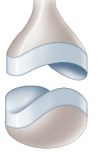 What type of synovial joint is listed in the picture?