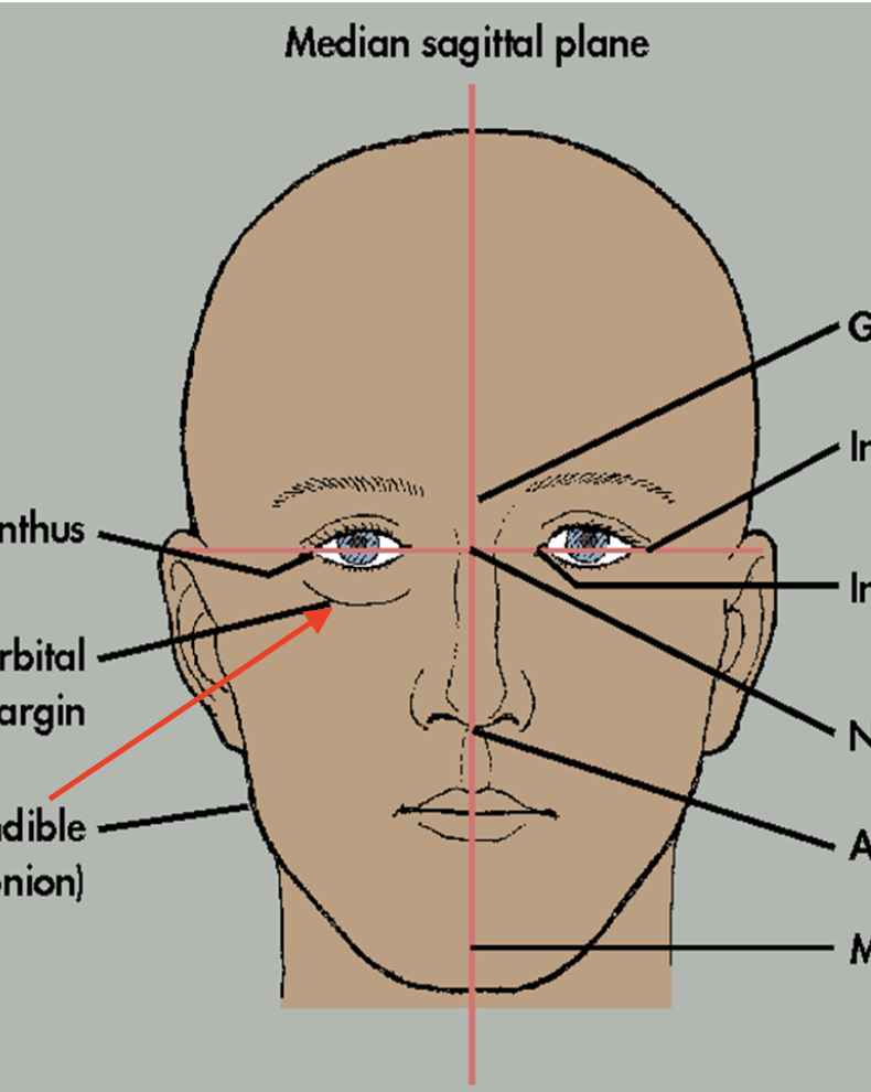 term image