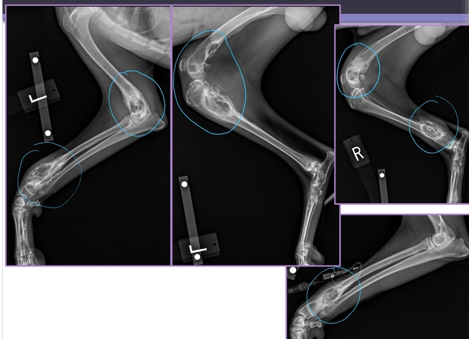 <p><span style="background-color: transparent;"><strong><span>Systemic Infection in Bone</span></strong></span></p>