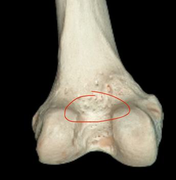 <p>superior ridge of intercondylar fossa </p>