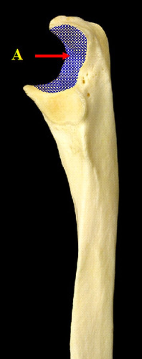 <p>articulation between ulna and trochlea of the humerus at the elbow joint, found on ulna</p>