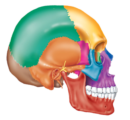 term image