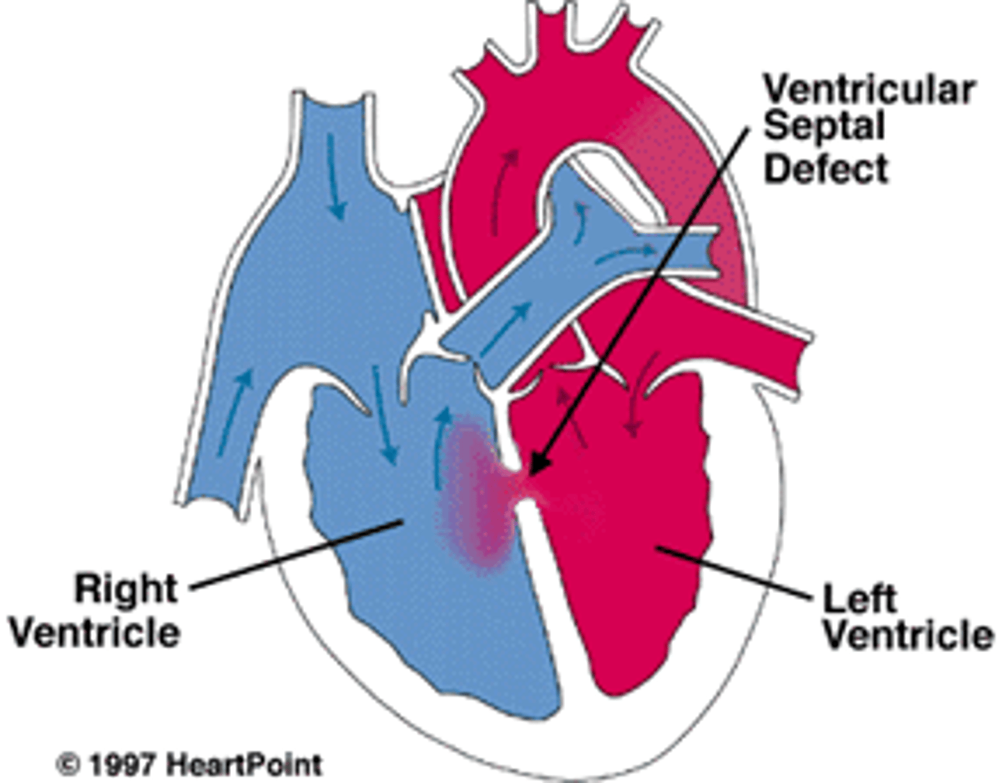 <p>Sweating with feeds, poor feeding, tachycardia</p>
